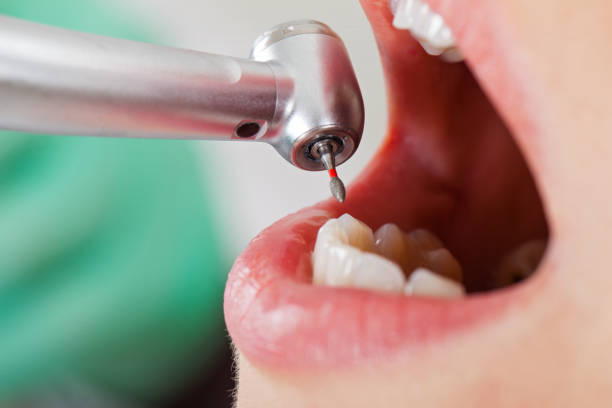 Best Pediatric Emergency Dentist in New Richmond, WI